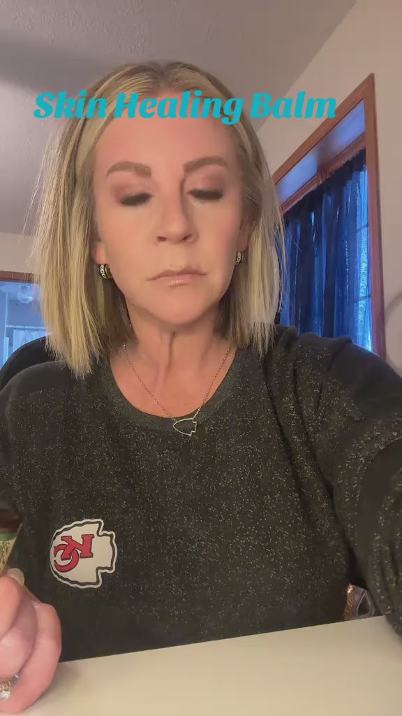Skin Healing Salve organic calendula herbal eczema salve