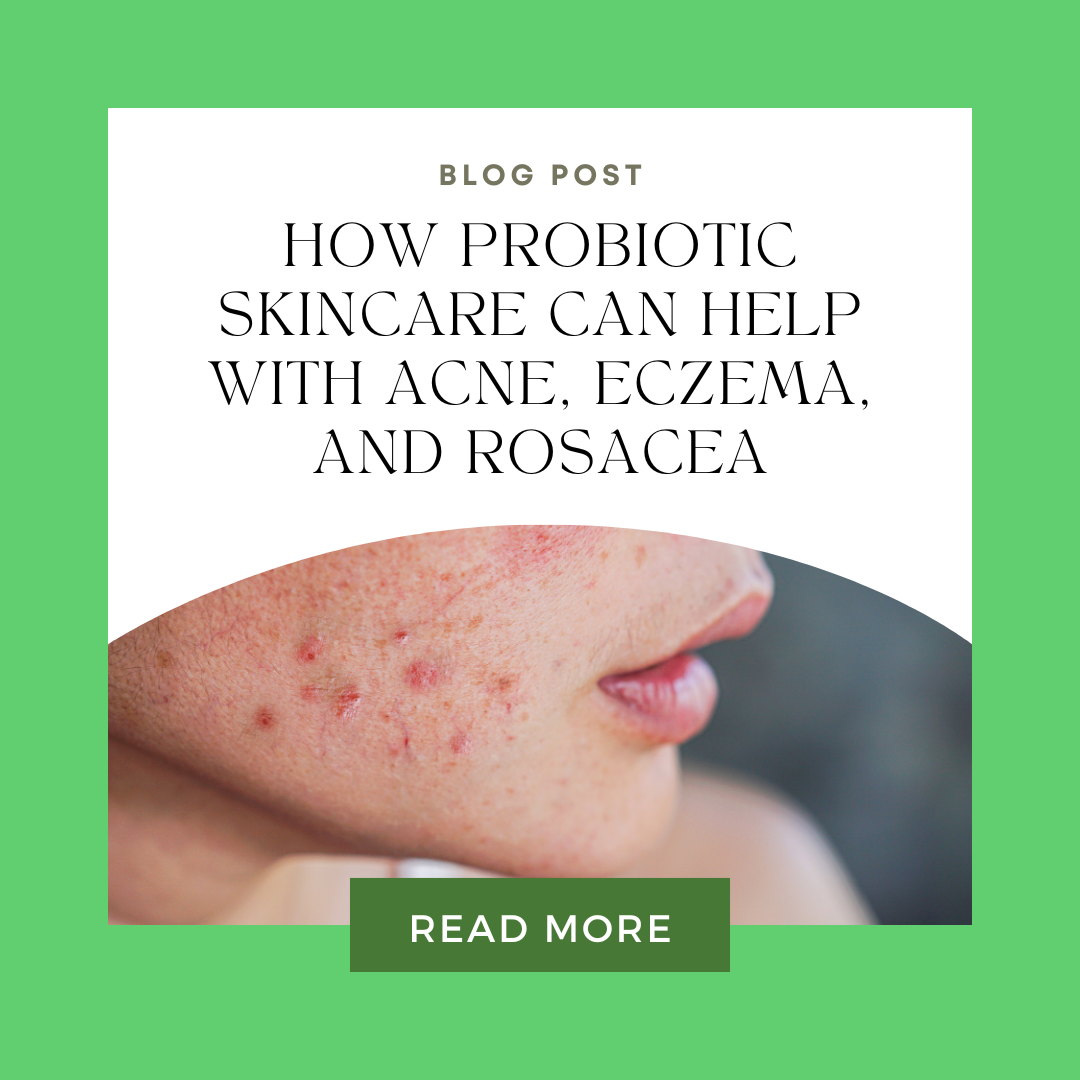 How Probiotic Skincare Can Help with Acne, Eczema, and Rosacea