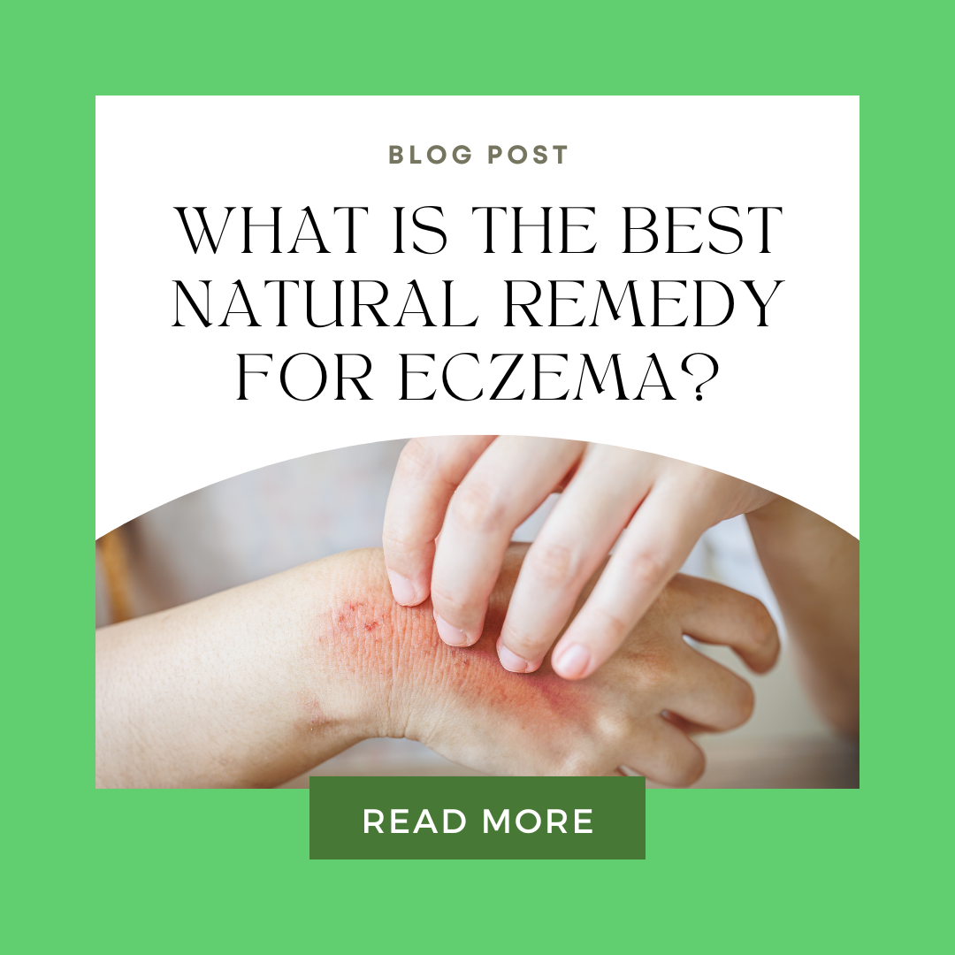 What Is the Best Natural Remedy for Eczema?