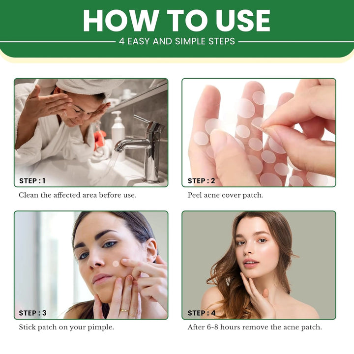 Hydrocolloid Acne Patches